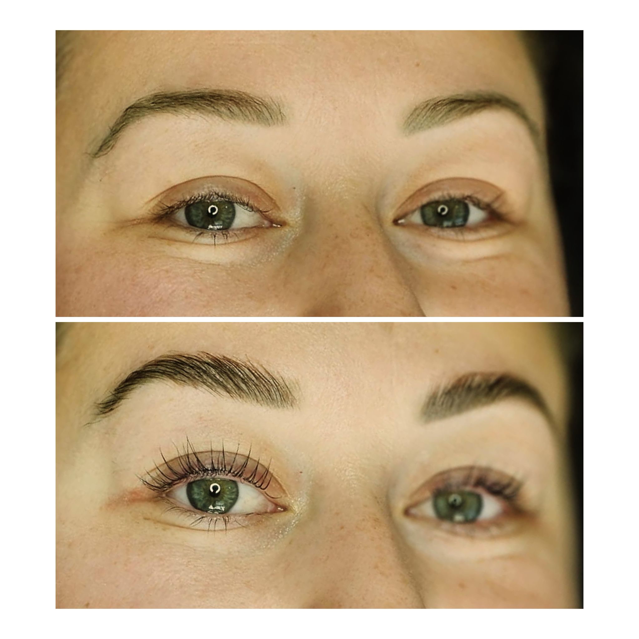 BROWLIFT2 browlift,yumi,cbio